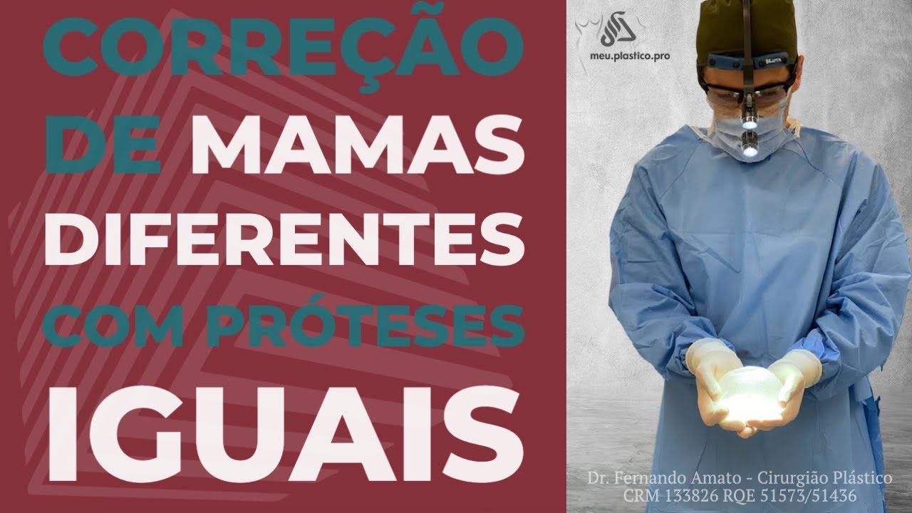 CORREÇÃO DE MAMAS DIFERENTES COM PRÓTESES IGUAIS