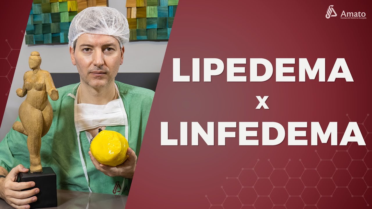 Qual a Diferença Entre Lipedema e Linfedema?